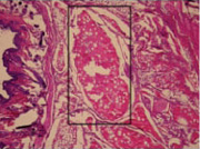 Circulating osteogenic precursor (COP) cells form bone in vivo. COP cells were transplanted into nude mice with histological sections revealing hard tissue containing osteoctyes and bone-lining cells (boxed area) eight weeks later. (Robert Pignolo, MD, PhD, University of Pennsylvania School of Medicine)